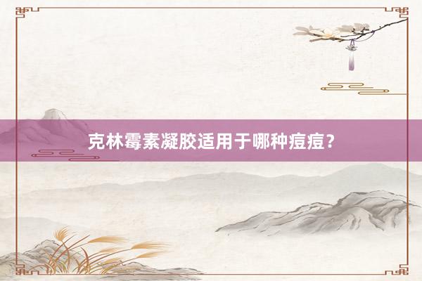 克林霉素凝胶适用于哪种痘痘？
